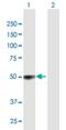 Terminal Uridylyl Transferase 7 antibody, H00079670-B01P, Novus Biologicals, Western Blot image 