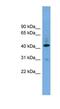 Beta-1,4-Galactosyltransferase 2 antibody, NBP1-59837, Novus Biologicals, Western Blot image 
