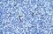 Annexin A3 antibody, GTX30892, GeneTex, Immunohistochemistry paraffin image 