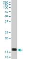 Acid Phosphatase 1 antibody, H00000052-M01, Novus Biologicals, Western Blot image 