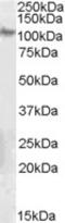 Synaptogyrin 2 antibody, 46-455, ProSci, Western Blot image 