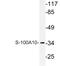 S100 Calcium Binding Protein A10 antibody, PA5-75432, Invitrogen Antibodies, Western Blot image 