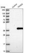 Tubulin Polyglutamylase Complex Subunit 2 antibody, NBP1-85062, Novus Biologicals, Western Blot image 