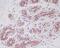 Cortactin antibody, M01253, Boster Biological Technology, Immunohistochemistry paraffin image 