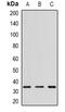 Cytotoxic T-Lymphocyte Associated Protein 4 antibody, abx225129, Abbexa, Western Blot image 