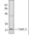 TIMP Metallopeptidase Inhibitor 2 antibody, orb87513, Biorbyt, Western Blot image 