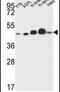 NADH:Ubiquinone Oxidoreductase Core Subunit S2 antibody, PA5-26772, Invitrogen Antibodies, Western Blot image 