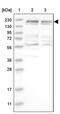 Serine/threonine-protein kinase MRCK beta antibody, PA5-54613, Invitrogen Antibodies, Western Blot image 