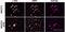 Vitamin D Receptor antibody, ab3508, Abcam, Immunofluorescence image 