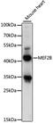 Myocyte Enhancer Factor 2B antibody, 16-363, ProSci, Western Blot image 