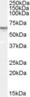 Phosphodiesterase 11A antibody, GTX89018, GeneTex, Western Blot image 