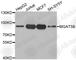 Alpha-1,6-Mannosylglycoprotein 6-Beta-N-Acetylglucosaminyltransferase B antibody, A3549, ABclonal Technology, Western Blot image 