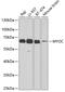 Myocilin antibody, A00977, Boster Biological Technology, Western Blot image 