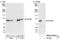 Karyopherin Subunit Beta 1 antibody, NB100-94993, Novus Biologicals, Western Blot image 