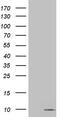 S100 Calcium Binding Protein A6 antibody, MA5-26658, Invitrogen Antibodies, Western Blot image 