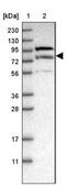 Leucine Rich Repeat And Sterile Alpha Motif Containing 1 antibody, NBP1-82016, Novus Biologicals, Western Blot image 