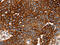 Ectodysplasin A Receptor antibody, CSB-PA083210, Cusabio, Immunohistochemistry paraffin image 