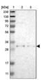 TNF Alpha Induced Protein 1 antibody, PA5-53043, Invitrogen Antibodies, Western Blot image 