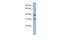 Mitochondrially Encoded Cytochrome C Oxidase III antibody, PA5-43531, Invitrogen Antibodies, Western Blot image 