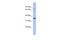 Nuclear Receptor Binding Protein 2 antibody, A13248, Boster Biological Technology, Western Blot image 