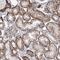 Pleckstrin Homology Domain Containing A5 antibody, NBP1-84612, Novus Biologicals, Immunohistochemistry paraffin image 