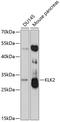 Kallikrein Related Peptidase 2 antibody, GTX33281, GeneTex, Western Blot image 