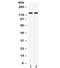 ABL Proto-Oncogene 2, Non-Receptor Tyrosine Kinase antibody, R32426, NSJ Bioreagents, Western Blot image 