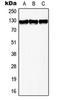 Telomerase Reverse Transcriptase antibody, orb215529, Biorbyt, Western Blot image 