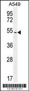 Arrestin Beta 1 antibody, 56-170, ProSci, Western Blot image 