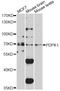 3-Phosphoinositide Dependent Protein Kinase 1 antibody, STJ24950, St John