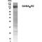 Gamma-Aminobutyric Acid Type B Receptor Subunit 2 antibody, GTX70358, GeneTex, Western Blot image 