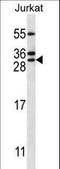 RAB5C, Member RAS Oncogene Family antibody, LS-C162389, Lifespan Biosciences, Western Blot image 