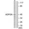 ADP Dependent Glucokinase antibody, PA5-49873, Invitrogen Antibodies, Western Blot image 