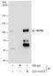 Nucleoporin 98 antibody, GTX114157, GeneTex, Immunoprecipitation image 