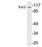 Kinase suppressor of Ras 2 antibody, LS-B9334, Lifespan Biosciences, Western Blot image 