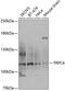 Transient Receptor Potential Cation Channel Subfamily C Member 4 antibody, GTX64614, GeneTex, Western Blot image 