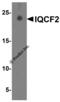 IQ Motif Containing F2 antibody, 8419, ProSci, Western Blot image 