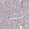 Prolyl Endopeptidase antibody, PA5-56725, Invitrogen Antibodies, Immunohistochemistry paraffin image 