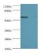 Prolyl 4-Hydroxylase Subunit Alpha 2 antibody, LS-C376255, Lifespan Biosciences, Western Blot image 