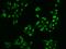 Siah E3 Ubiquitin Protein Ligase 2 antibody, 207275-T02, Sino Biological, Immunohistochemistry paraffin image 