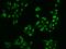 E3 ubiquitin-protein ligase SIAH2 antibody, 207275-T02, Sino Biological, Immunohistochemistry paraffin image 