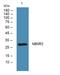 Cytochrome B5 Reductase 2 antibody, A11240, Boster Biological Technology, Western Blot image 