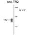 Nuclear Receptor Subfamily 2 Group C Member 1 antibody, GTX82577, GeneTex, Western Blot image 