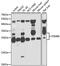 Proteasome Subunit Beta 8 antibody, 22-875, ProSci, Western Blot image 