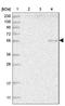 Hyaluronidase 2 antibody, NBP1-81283, Novus Biologicals, Western Blot image 