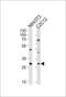 Homeobox protein Hox-C9 antibody, GTX53564, GeneTex, Western Blot image 