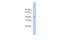 Mitochondrial ribonuclease P protein 1 antibody, A09612, Boster Biological Technology, Western Blot image 