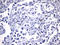 FOXP3 antibody, LS-C797044, Lifespan Biosciences, Immunohistochemistry paraffin image 