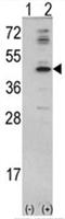 Mevalonate Diphosphate Decarboxylase antibody, AP17571PU-N, Origene, Western Blot image 