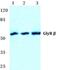 Glycine Receptor Beta antibody, PA5-36958, Invitrogen Antibodies, Western Blot image 